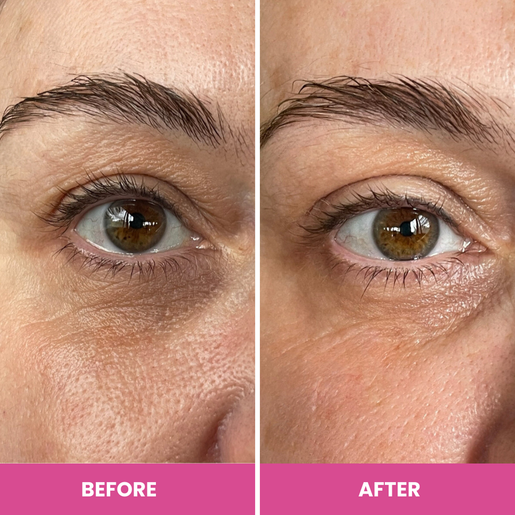 PrimeEyes Hydrate