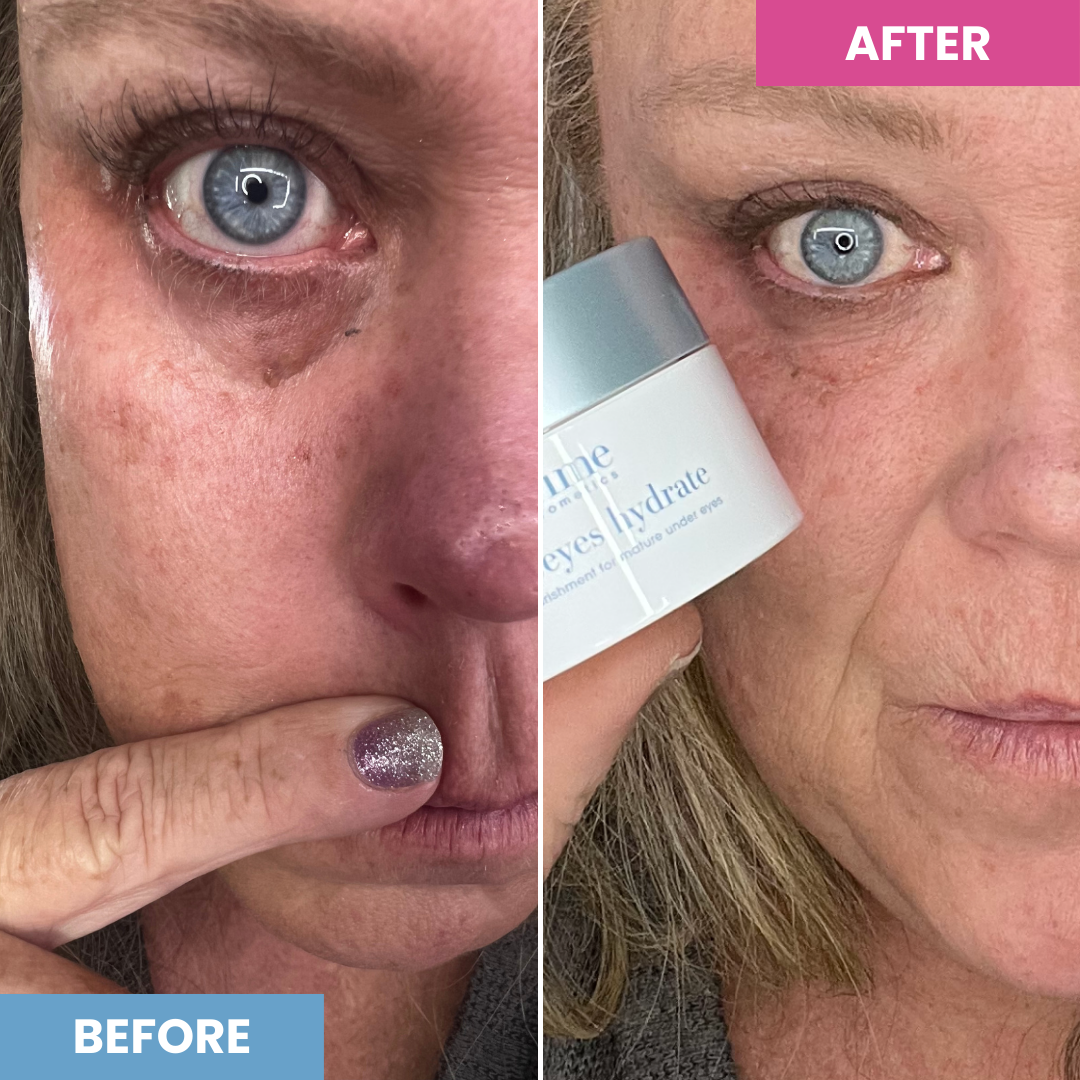 PrimeEyes Hydrate