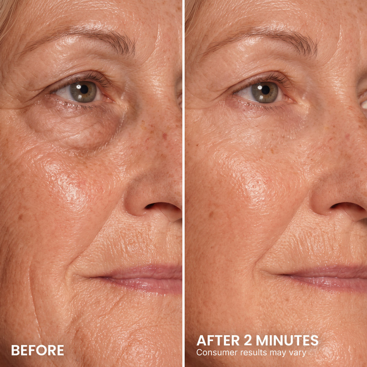 PrimeLift Instant Eye Tightener