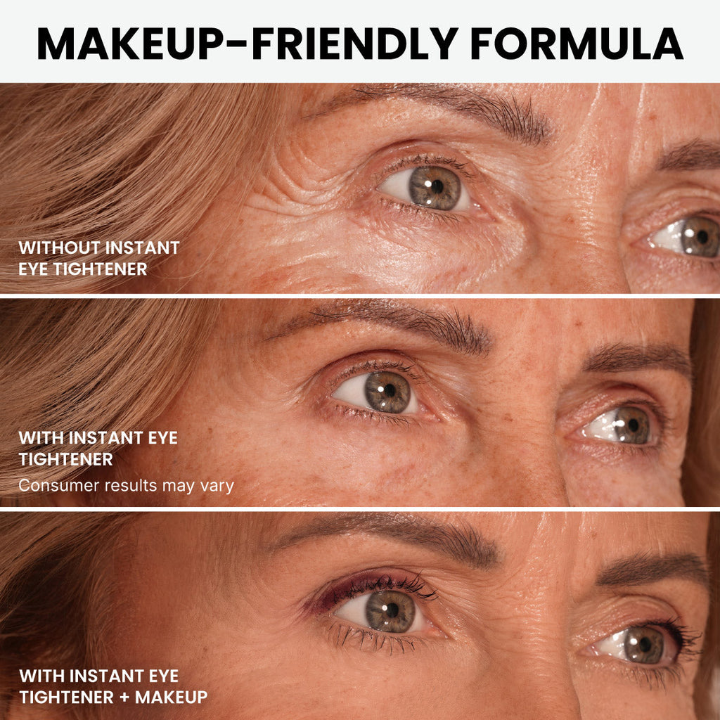 Undereye Rescue Duo
