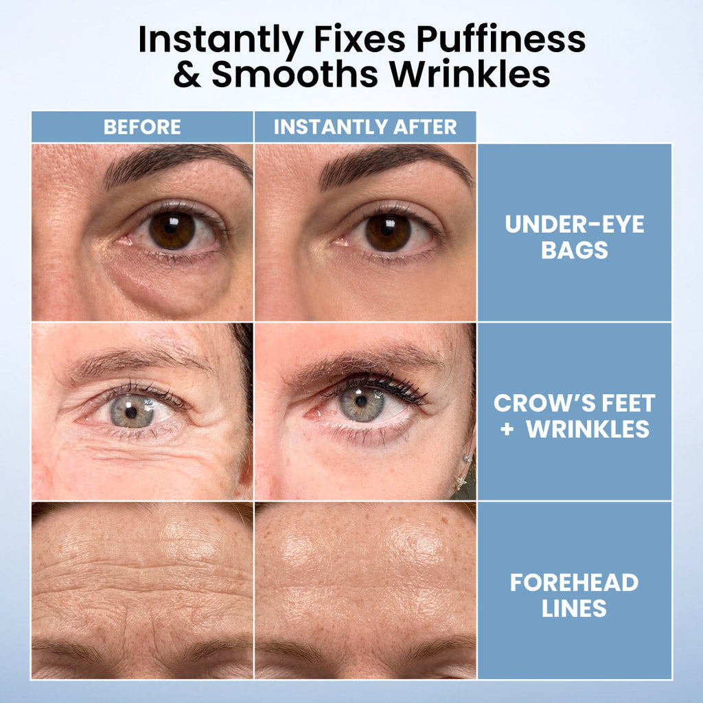 PrimeLift Instant Eye Tightener